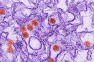 This is a transmission electron micrograph (TEM) of Zika virus, which is a member of the family Flaviviridae. Virus particles are 40 nm in diameter, with an outer envelope, and an inner dense core. Additional Information:“Zika virus is spread to people through mosquito bites. The most common symptoms of Zika virus disease are fever, rash, joint pain, and conjunctivitis (red eyes). The illness is usually mild with symptoms lasting from several days to a week. Severe disease requiring hospitalization is uncommon.”For more information on the Zika virus, follow the link below.