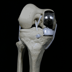 Knee_Rep_Oxford_1
