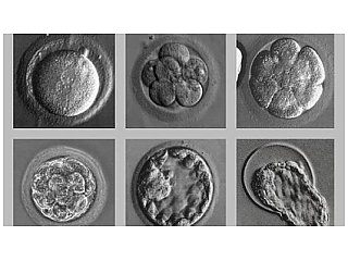 Nou moontlik: genetiese toetse op embrio