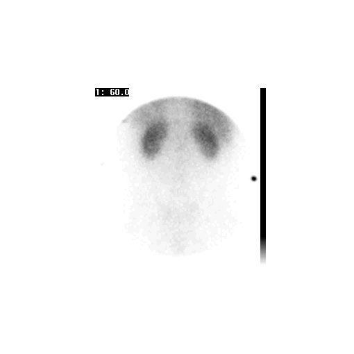 renogram-normaal-dinamies