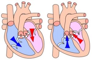 Hierdie skets toon (andersom as die skets hierbo) eerste hoe die ventrikels gevul word en watter kleppe dan oop en toe is (links, diastolie) en dan watter kleppe oop en toe moet wees met sametrekking (regs).