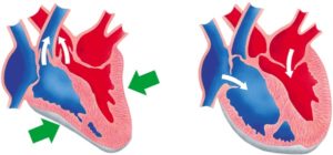 systolediastole